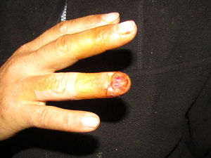 Finger-Jul23.jpg